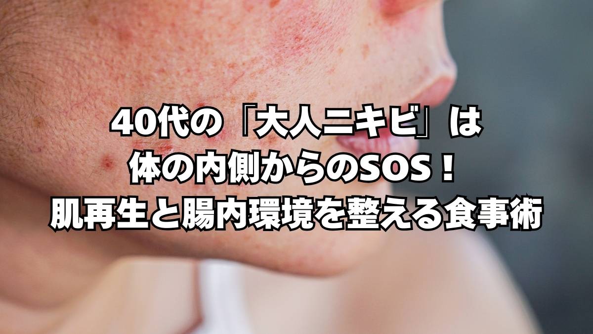 40代のニキビ